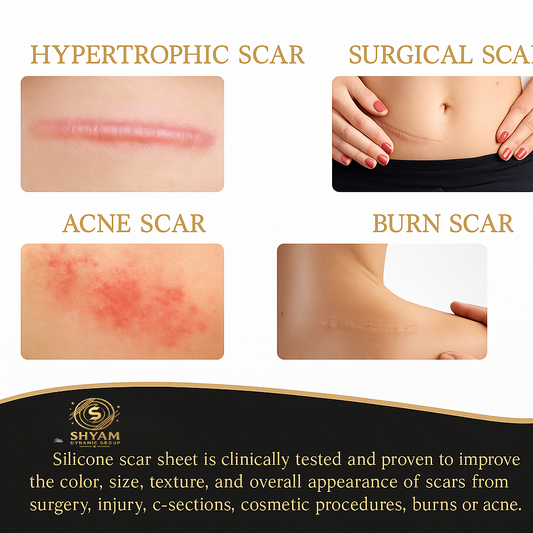 Professional Silicone Scar Tape – Reduces Appearance of Scars from Surgery, Burns, Cuts & Acne – Doctor Recommended