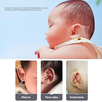Roll Baby Ear Correction Tape for Protruding Ears – Infant Ear Aesthetic Corrector Stickers, Ear Cleaner Tool for Kids