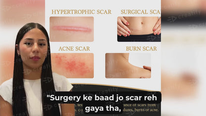 Professional Silicone Scar Tape – Reduces Appearance of Scars from Surgery, Burns, Cuts & Acne – Doctor Recommended